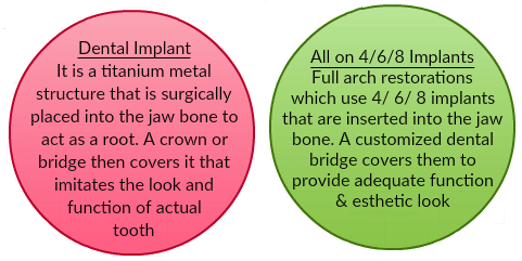 Single and All-on-4-6-8 Implants