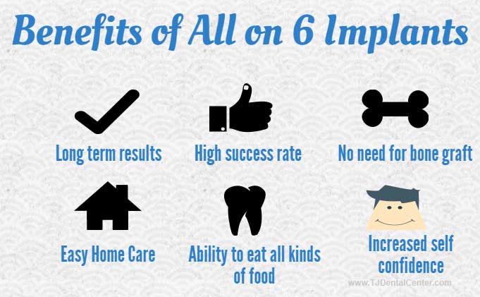 Benefits of All-on-6 Dental Implants