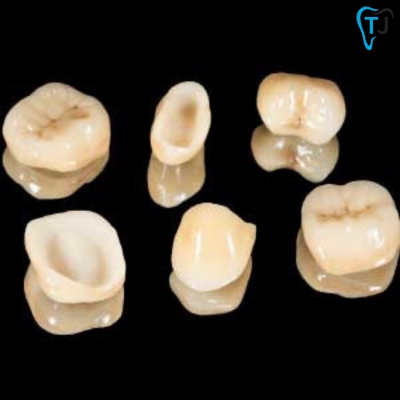 Dental Crowns